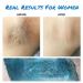Waxing Kit for Women and Men with Strongest Blue Refill Hard Wax - At-Home Hair Removal for Underarms, Legs, Back, and Chest - Stripless Wax Warmer - Coarse Body Hair Removal - Buy Online on SooperMarket.com