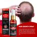 Ceessting Hair Growth Spray - Biotin, Caffeine & Niacinamide - 2oz Anti-Hair Loss & Regrowth Treatment for Men & Women - Buy Online on SooperMarket.com