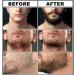 Complete Beard Growth Kit for Men - Beard Roller, Wash, Serum, Oil, Balm, Brush, Comb, Scissor, eBook - Perfect Beard Grooming and Care Gift Set - Buy Online on SooperMarket.com