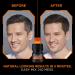 L'Oreal Paris Men Expert Dark Brown Permanent Haircolor 1 Application Kit - Covers Grays, Mess-Free, 2 Count - Buy Online on SooperMarket.com