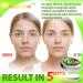Cystic Acne Treatment & Scar Remover - USA Made Severe Acne Cleanser with Tea Tree Oil - Prevent Breakouts - Natural Pimple Cream - Buy Online on SooperMarket.com