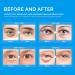 Enaskin Naturals 24K Gold Under Eye Patches for Puffy Eyes & Dark Circles - Under Eye Treatment for Women and Men - Reduce Wrinkles and Eye Bags (Blue) - Buy Online on SooperMarket.com
