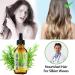 Rosemary Essential Oil for Hair Growth & Skin Care (2 Fl Oz) - Stimulates Growth, Nourishes Scalp, Improves Circulation - Hair Loss Treatment - Buy Online on SooperMarket.com