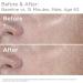 SkinMedica HA5 Rejuvenating Hydrator 2 Oz - Advanced Hyaluronic Acid Serum - Buy Online on SooperMarket.com