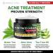 Acne Medication Face Cream - Fast Acting USA-Made Treatment for Stubborn Pimples, Blackheads, Whiteheads - Soothing Moisturizer for Acne Relief & Scar Prevention - 2oz - Buy Online on SooperMarket.com