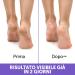 Podovis C/Talloni Screpolati 75 ml - Healing Cream for Cracked Heels | International Shipping Available - Buy Online on SooperMarket.com
