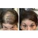 Dark Brown Hair Loss Concealer Trial Size - Cover Bald Spots Instantly - 10-Day Supply - All-Natural Fiber Formula - Buy Online on SooperMarket.com