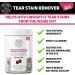 Tear Stain Remover Supplement 65 Soft Chews | Removes Tear Stains | Stimulates Immune System | Antioxidants | Resist Allergens | Veterinarian Formulated - Buy Online on SooperMarket.com