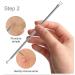 Blackhead Remover Comedone Squeezer Set Blackhead Remover Pore Cleanser Facial Cleansing Pimples Acne Whiteheads Blackhead Remover Kit with Box of 4 - Buy Online on SooperMarket.com