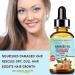Botanical Beauty Babassu Oil - 100% Pure Natural Refined Cold-Pressed Carrier Oil for Face Skin Body Hair & Nails - Rich in Vitamin E & C - 1 Fl oz (30 ml - Buy Online on SooperMarket.com
