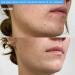 PMD Clean Acne - Smart Facial Cleansing Device with Silicone Brush & Blue Light Treatment for Acne - Waterproof & SonicGlow Technology - Buy Online on SooperMarket.com