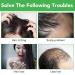 Hair Growth Serum & Rosemary Shampoo - Biotin & Castor Oil for Hair Loss | Effective Regrowth Products for Women & Men - Buy Online on SooperMarket.com