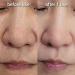 Hydrogen Dual Skin Changer Set | Hydrating Anti-Aging K-Beauty Therapy | International Shipping - Buy Online on SooperMarket.com