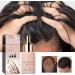 Nmbol Hair Growth Spray 1 - Buy Online on SooperMarket.com