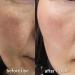 Hydrogen Dual Skin Changer Set | Hydrating Anti-Aging K-Beauty Therapy | International Shipping - Buy Online on SooperMarket.com