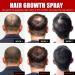Ceessting Hair Growth Spray - Biotin, Caffeine & Niacinamide - 2oz Anti-Hair Loss & Regrowth Treatment for Men & Women - Buy Online on SooperMarket.com