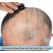 Premium Omnishaver with Cartridge Kit - Fastest Head & Body Shaving Alternative | Self-Cleans & Strops | Durable Blade | Bald Head Shaver - Buy Online on SooperMarket.com
