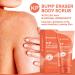 KP Bump Eraser Body Scrub - Exfoliating Strawberry Legs Treatment for Women & Men - 8.45oz - Buy Online on SooperMarket.com
