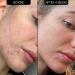 Buy INKEY List SuperSolutions Novoretin 2% Moisturizer - Skin Clearing Blemish Reduction Non-Comedogenic - International Shipping Available - Buy Online on SooperMarket.com