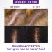 Head & Shoulders Scalp X 2% Minoxidil for Women - Hair Regrowth Treatment Thinning Hair & Hair Loss Solution 3 Month Supply (3 x 2 Fl Oz - Buy Online on SooperMarket.com