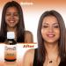 Carotis Brightening Serum 1oz - Fade Brown Spots with Alpha Arbutin & Beta Carotene - Buy Online on SooperMarket.com