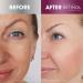 Retinol Anti-Aging Starter Kit: Cleanse, Treat, Repair, Hydrate - Travel size for a Youthful Glow! - Buy Online on SooperMarket.com