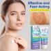 Tinea Versicolor Natural Skin Cream - Effective Treatment for All Skin Types - Buy Online on SooperMarket.com
