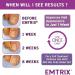 Emtrix Nail Fungus Solution 10 ml - Buy Online on SooperMarket.com