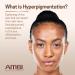 Ambi Even & Clear Fade Cream - Hyperpigmentation Treatment, Dark Spot Corrector with Niacinamide & Licorice Root Extract - 1 Fl Oz - Buy Online on SooperMarket.com