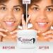 Geisha Kojic Acid Cream - 1.7 fl oz - Dark Spot Remover for Face, Body & Hands - Hyperpigmentation Treatment with Glycolic Acid - Buy Online on SooperMarket.com
