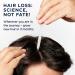 Head & Shoulders Scalp X Minoxidil for Men - Pack of 3 - 2 Fl Oz. - Buy Online on SooperMarket.com