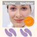 Amathings Reusable Silicone Eye Pads - Anti-Aging Tear Bags & Wrinkles Relief | 100% Eco-Friendly | 2 Pairs in Quality Storage Box - Buy Online on SooperMarket.com