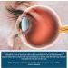 BASE LABORATORIES Corneal Edema Eye Ointment | 3% Sodium Chloride Ophthalmic | Hypertonicity Eye Drops - Triple Pack 15g - Buy Online on SooperMarket.com
