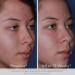 Obagi CLENZIderm M.D. Acne Treatment System | 3-Step 2% Salicylic Acid & 5% Benzoyl Peroxide | International Shipping - Buy Online on SooperMarket.com