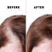 Bald Spot Hair Growth Cream | Scalp Treatment for Receding Hair | Just Nutritive | 4 Oz | Unisex Hair Restoration - Buy Online on SooperMarket.com