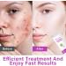 Azelaic Acid Serum Cream 12% Azelaic Acid Cream Redness Relief Face Balance Excess Sebum 20ml - Buy Online on SooperMarket.com