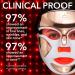 Dr. Dennis Gross DRx SpectraLite DPL FaceWare Pro - Smooths Fine Lines, Firms Skin, Prevents Acne, Reduces Redness (White) - Buy Online on SooperMarket.com
