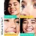 Patchology Acne Nose Strips - Hydrocolloid Patches for Clearer Skin | Gentle & Effective 5 Ct - Buy Online on SooperMarket.com