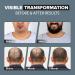 VOID Homme Derma Roller - Professional Microneedling Beard Roller with 540 Titanium Needles - Stimulates Hair Growth & Collagen Production - Targets Wrinkles Fine Lines Stretch Marks Dark Spots - Buy Online on SooperMarket.com