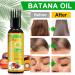 Batana Oil for Hair Growth 120ml Raw Batana Oil Organic from Honduras - for Thicker & Stronger Hair Scalp and Hair Oil Men & Women All Hair Types - Buy Online on SooperMarket.com