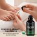 Fiora Naturals Tea Tree Essential Oil 1 oz - 100% Pure Organic Melaleuca Alternifolia for Face, Hair, Skin, Acne, Scalp, Foot, and Toenails - Buy Online on SooperMarket.com