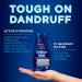 Selsun Blue ACTIV Hydration Anti-Dandruff Shampoo 300mL Controls Dandruff and Flaking Moisturizes Scalp - Buy Online on SooperMarket.com