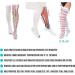 Invera Anti-Embolism Compression Stockings - Thigh High Unisex Ted Tube Socks 15-20mmHg Moderate Level XL | International Shipping - Buy Online on SooperMarket.com