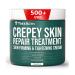 TreeActiv Crepey Skin Repair Treatment with Retinol for Face & Body | Anti-Wrinkle Serum - Buy Online on SooperMarket.com