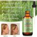 Rosemary Oil for Hair Growth Rosemary Oil for Skin Face 100% Pure Natural Improved Hair Growth Nourishes Scalp Rosemary Hair Oil For Men Women - Buy Online on SooperMarket.com