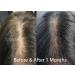 GHK-cu Copper Peptide Hair Regrowth Shampoo for Men & Women - Boost Hair Growth Nourish & Revitalize Shop Internationally - Buy Online on SooperMarket.com