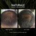 Naturale Shampoo for Thinning Hair - All-Natural Physician-Formulated Blend with Saw Palmetto & Essential Nutrients - 200 ML - Buy Online on SooperMarket.com