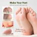 PURDERM Shiny & Soft Foot Peeling Mask (6 Pack) - Exfoliating Treatment for Cracked, Dry, Callused Feet - Removes Dead Skin & Reveals Baby Soft, Smooth Skin - Lemon & Natural Botanical Extracts - Buy Online on SooperMarket.com