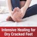 Kerasal Intensive Foot Repair Ointment - 1 oz for Cracked Heels & Dry Skin - Buy Online on SooperMarket.com