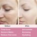 Retinol Moisturizer Cream For Face&Eye Area Anti Aging Wrinkles & Acne & Fine Lines with Vitamin E&Hyaluronic Acid & Jojoba Oil.Best Night&Day Facial Cream.With 2.5% Active Retinol (50Milliliter) - Buy Online on SooperMarket.com